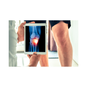 Bone-on-Bone Knee Pain