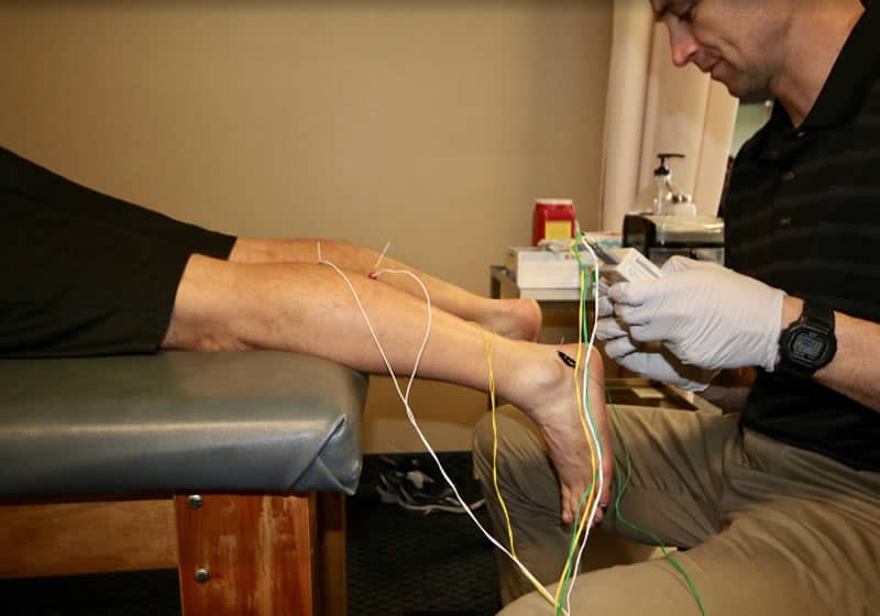 Trigger Point Dry Needling (TDN) 2 Cupping