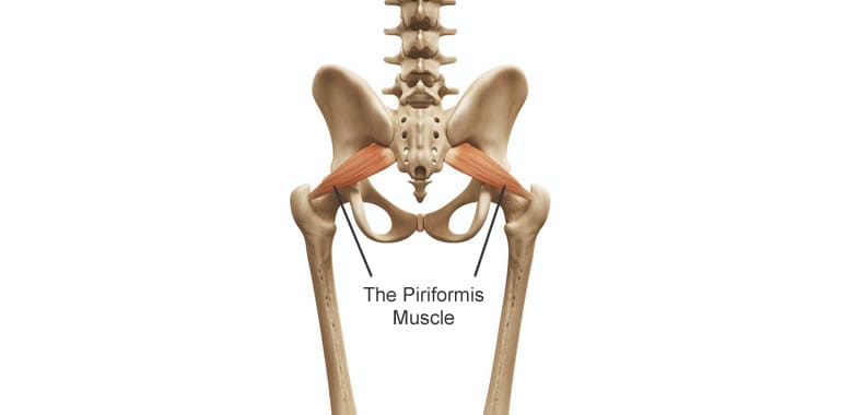 Piriformis Syndrome: A pain in the butt!