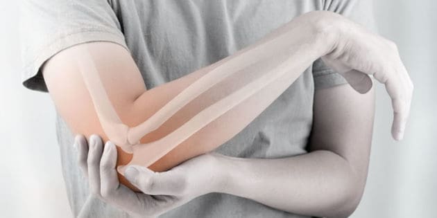 Tendonitis